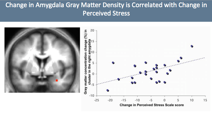 Change in grey matter density